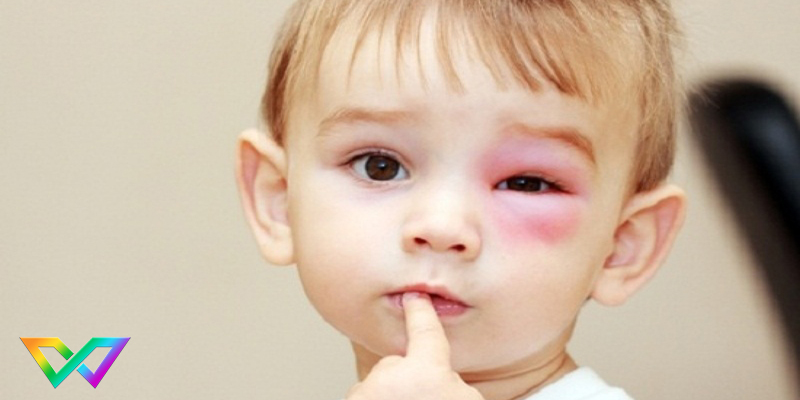 mơ thấy ong đốt nên đánh con gì